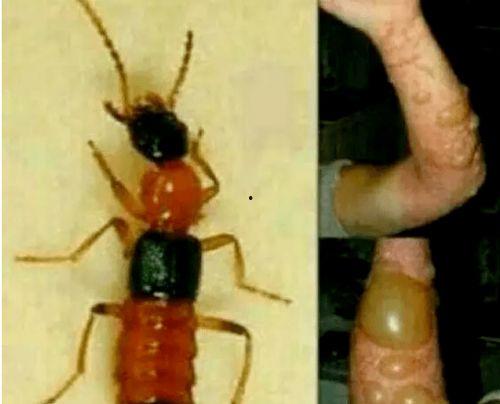 昆虫学者新皮肤爆料视频,新皮肤爆料视频深度解析