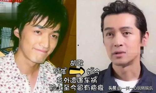 凄惨毁容的明星今昔,凄惨明星的今昔对比