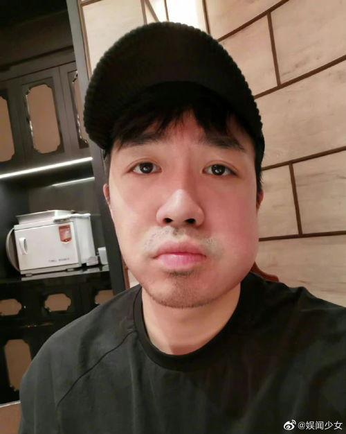 哪些明星拔过牙,揭秘拔牙背后的明星故事